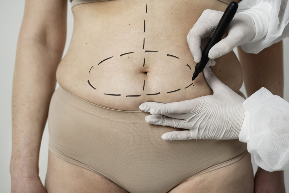 Con la morte di una 46enne equadoregna, che si era sottoposta, a Roma, ad un intervento di liposuzione, si allunga ulteriormente la lista delle donne